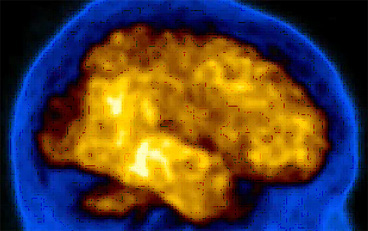 Bild "Home:2026_Kurs_Neuronuklearmedizin.jpg"